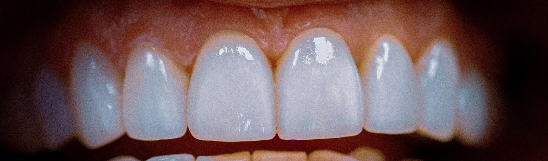 Birdwell & Mutlak Dentistry smile makeover after — Thompson's Station, TN