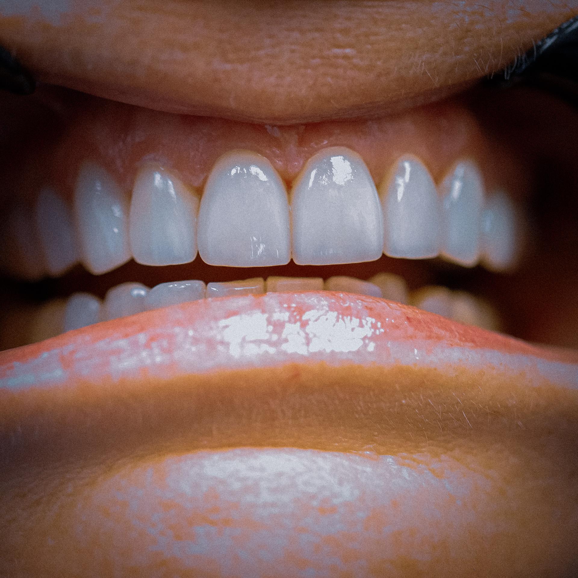 Birdwell & Mutlak Dentistry smile makeover after — Thompson's Station, TN