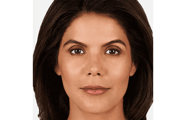 Pure Med Spa after — Chicago, IL