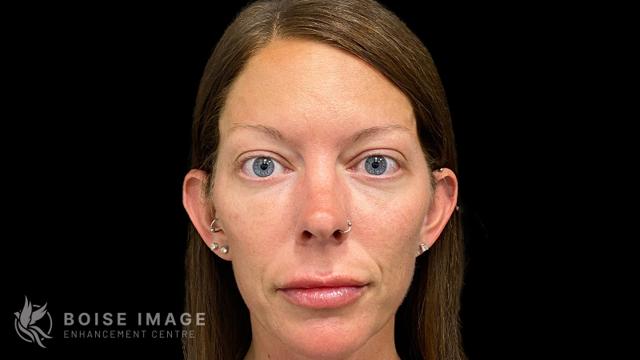 Boise Image Enhancement Center, Inc provider photo