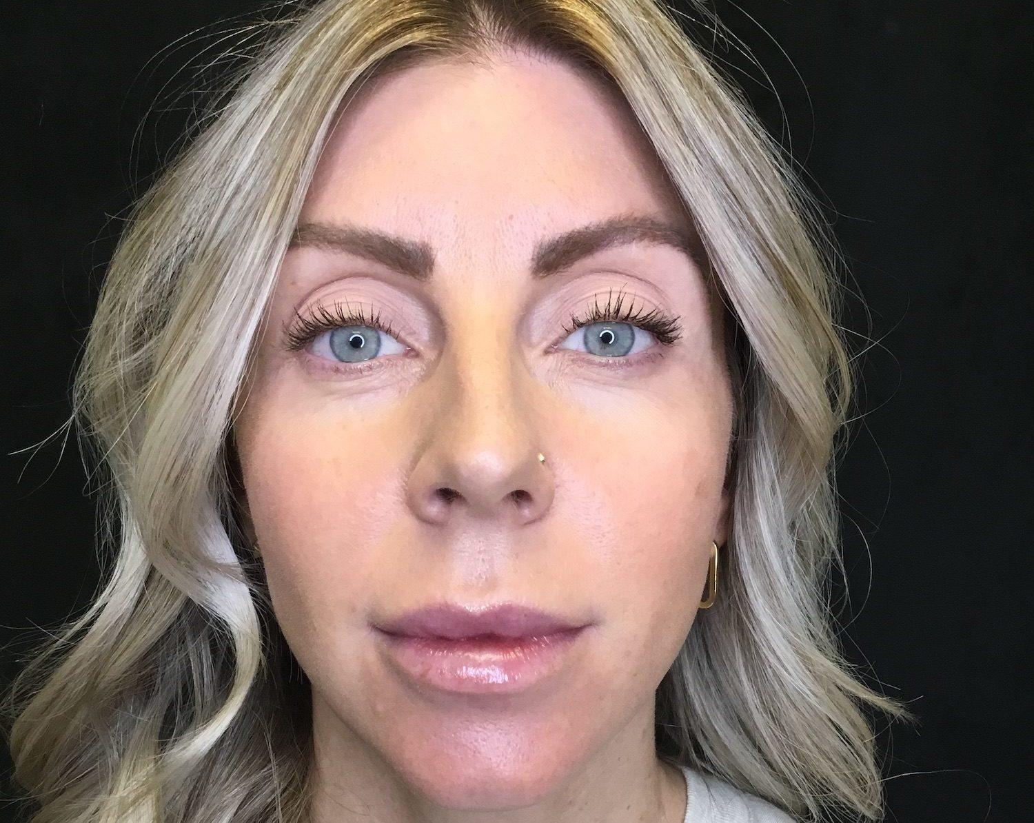 Inside Out Aesthetics after — Scottsdale, AZ
