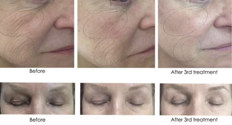 Renew Wellness & Aesthetics result — Oklahoma City, OK
