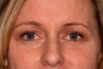 North Coast Plastic Surgery after — Oceanside, CA