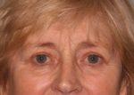 North Coast Plastic Surgery after — Oceanside, CA