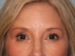 North Coast Plastic Surgery after — Oceanside, CA