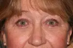 North Coast Plastic Surgery after — Oceanside, CA