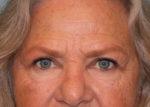 North Coast Plastic Surgery after — Oceanside, CA