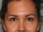 North Coast Plastic Surgery after — Oceanside, CA