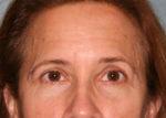 North Coast Plastic Surgery after — Oceanside, CA