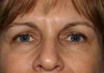 North Coast Plastic Surgery after — Oceanside, CA