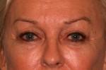North Coast Plastic Surgery after — Oceanside, CA