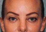 North Coast Plastic Surgery after — Oceanside, CA