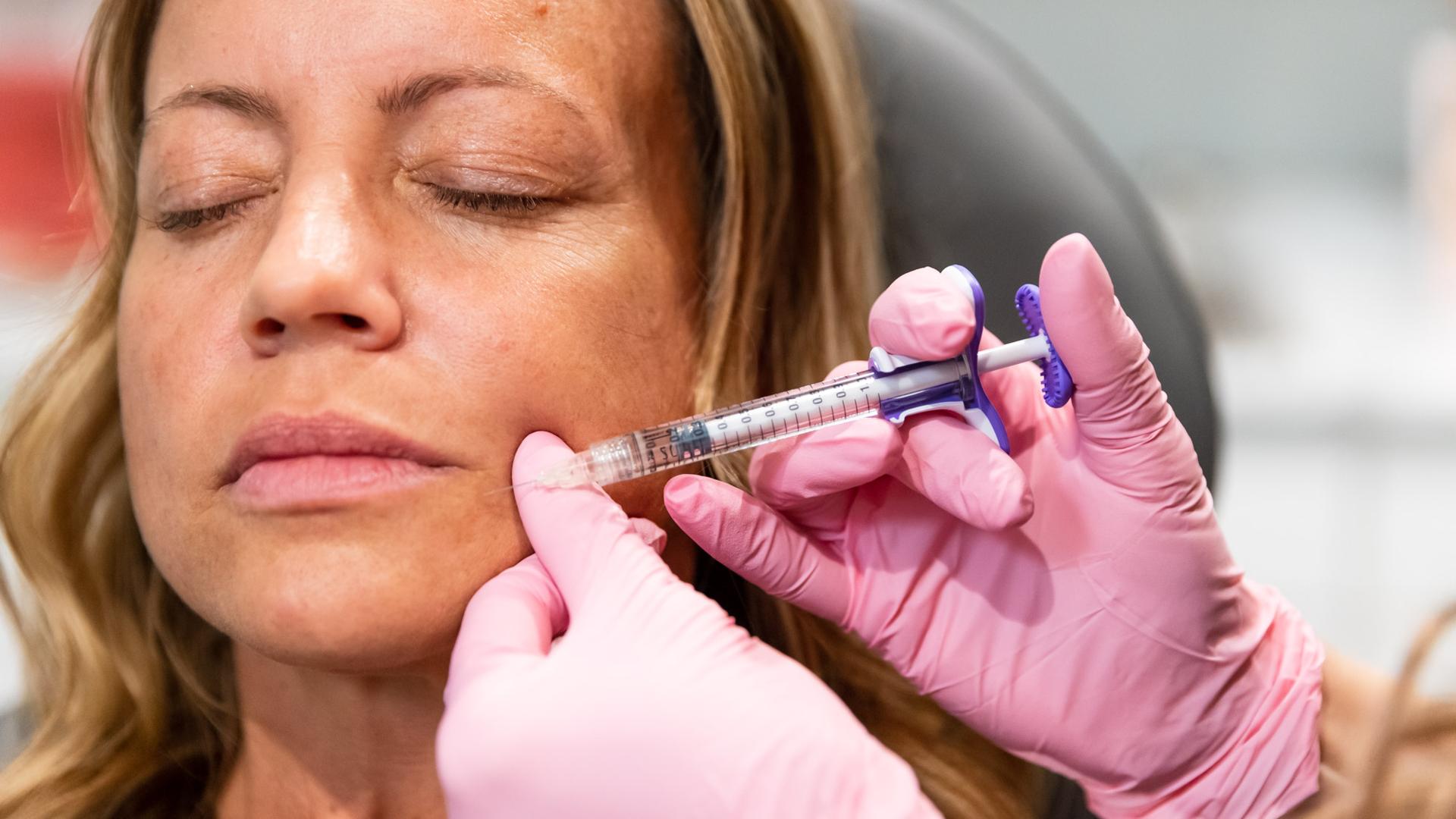 Blush Aesthetics lip filler result — Columbus, OH
