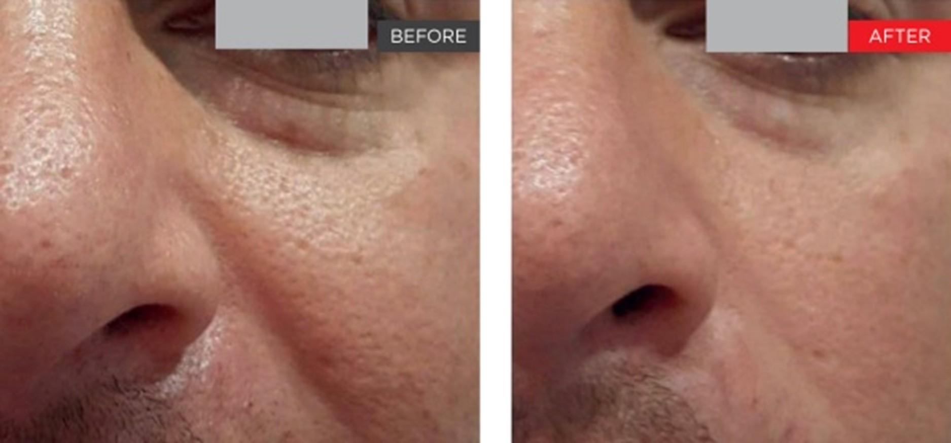 Brightside Aesthetics result — Clive, IA