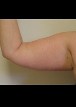 Kelly R. Kunkel, MD, PA after — Fort Worth, TX