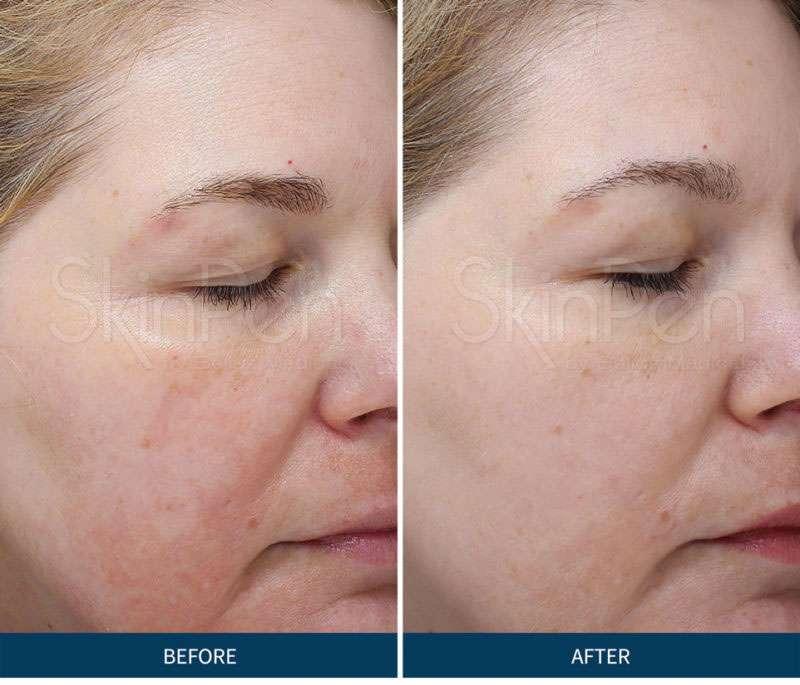 MD Wellness & Aesthetics result — Birmingham, AL