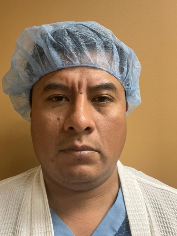 Rhinoplasty before at Tseng Plastic Surgery in Bellevue, WA