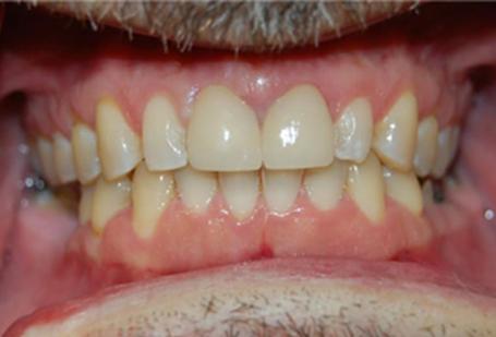 Berry Farms Dental smile makeover after — Franklin, TN