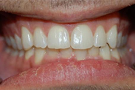 Berry Farms Dental smile makeover after — Franklin, TN