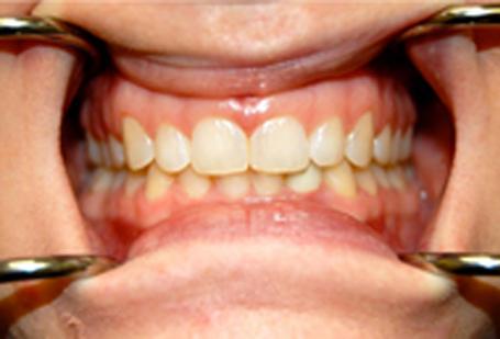 Berry Farms Dental smile makeover after — Franklin, TN