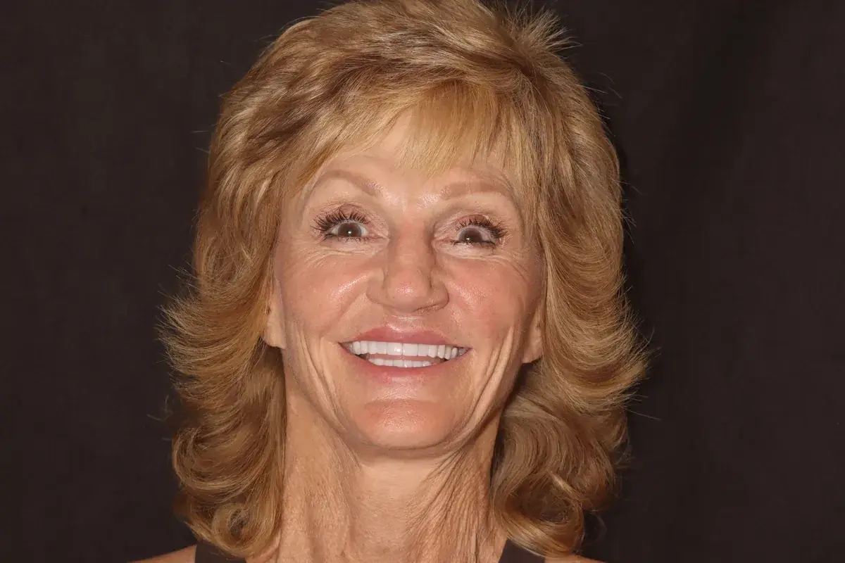 Rod Gleave DMD veneers after — Salt Lake City, UT