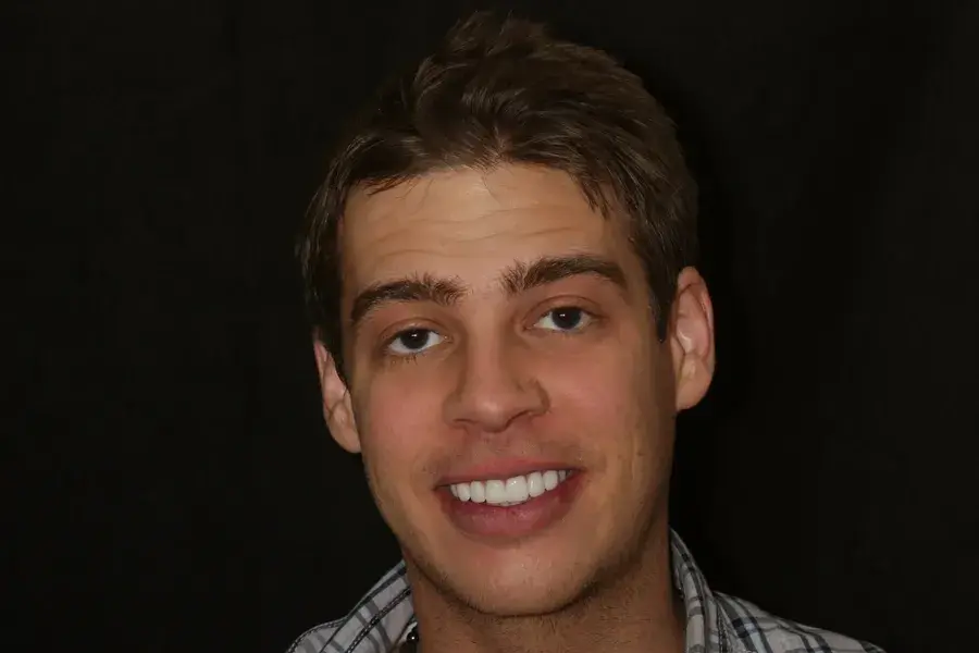 Rod Gleave DMD veneers after — Salt Lake City, UT
