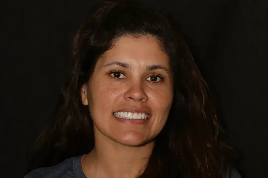 Rod Gleave DMD veneers after — Salt Lake City, UT