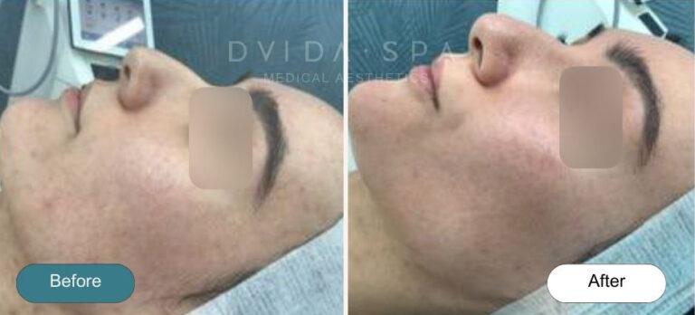Dvida Spa | Med Spa Services 60654 result — Chicago, IL