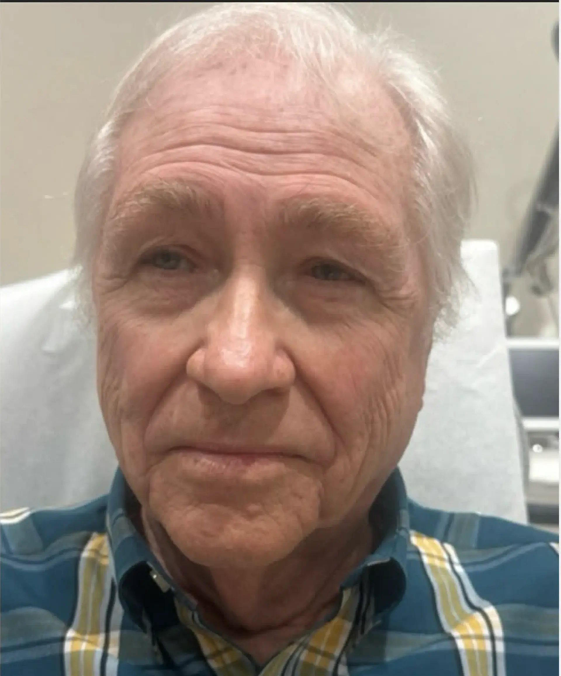 Dynasty Day & Med Spa laser treatment after — Albuquerque, NM