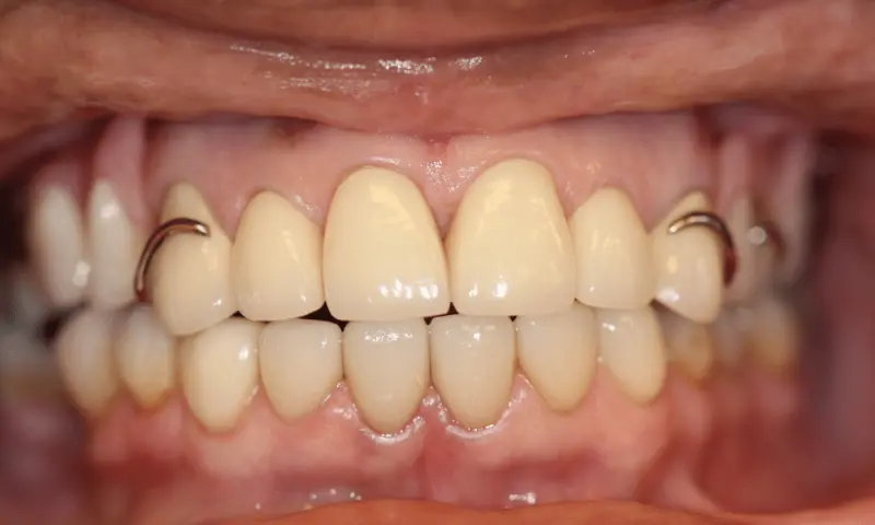 Station Park Dental after — Farmington, UT
