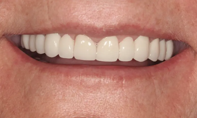 Station Park Dental after — Farmington, UT