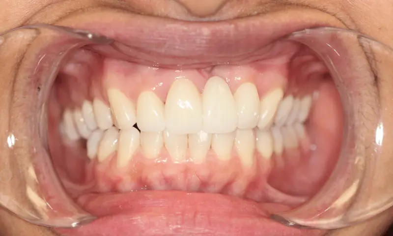Station Park Dental after — Farmington, UT