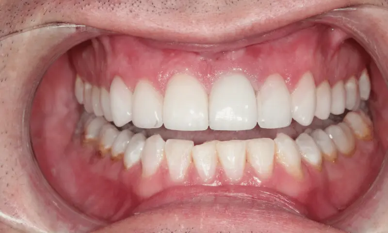 Station Park Dental after — Farmington, UT