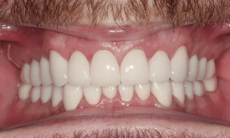 Station Park Dental after — Farmington, UT