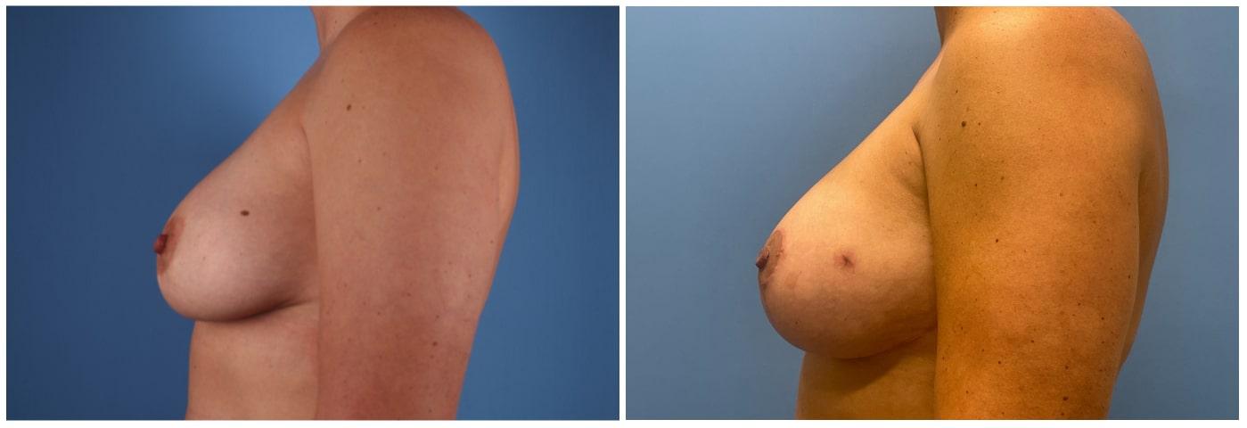 Dr. Ashley Steinberg - Trouvaille Aesthetics & Plastic Surgery result — Houston, TX