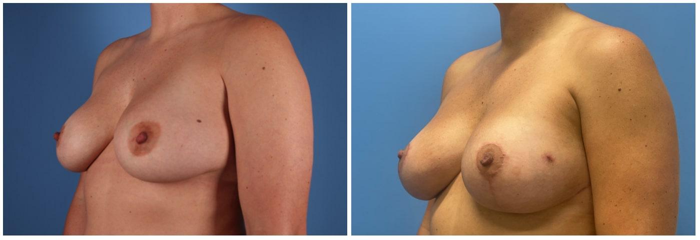 Dr. Ashley Steinberg - Trouvaille Aesthetics & Plastic Surgery result — Houston, TX