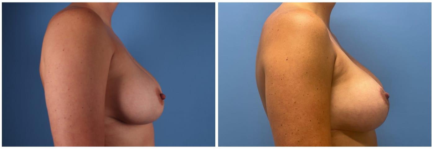 Dr. Ashley Steinberg - Trouvaille Aesthetics & Plastic Surgery result — Houston, TX