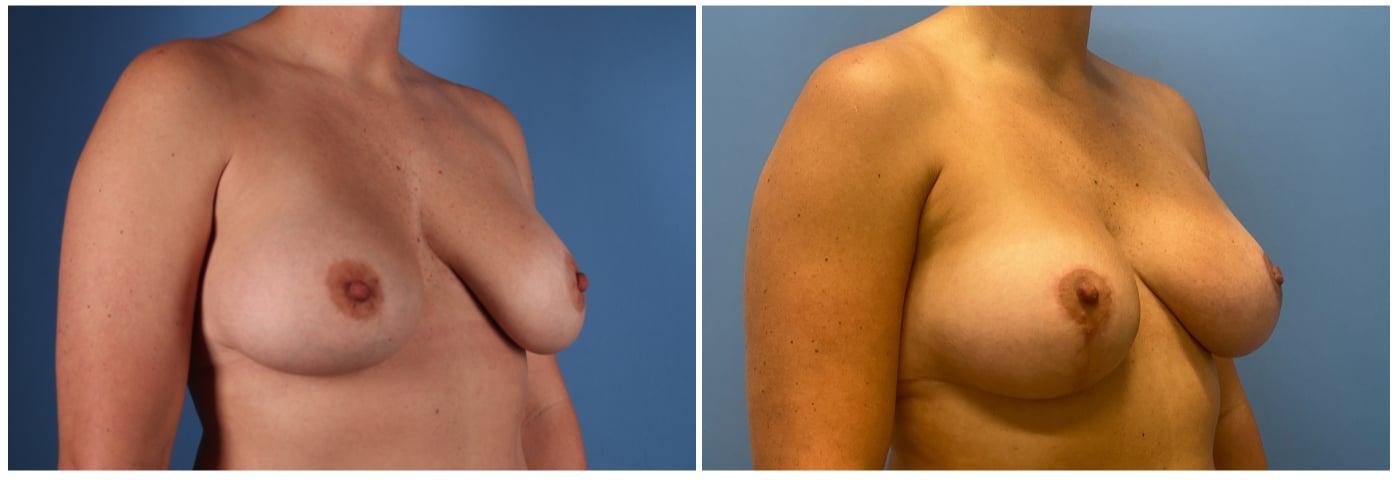Dr. Ashley Steinberg - Trouvaille Aesthetics & Plastic Surgery result — Houston, TX