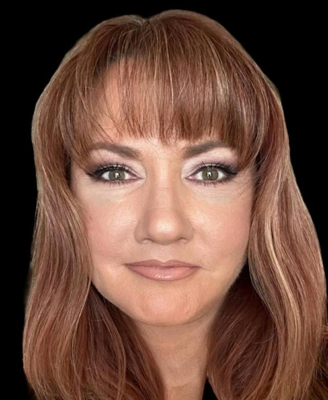 Facelift after at Dr. Kristy Hamilton in Houston, TX