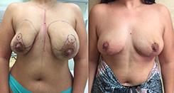 Dr. Stuart Linder result — Beverly Hills, CA