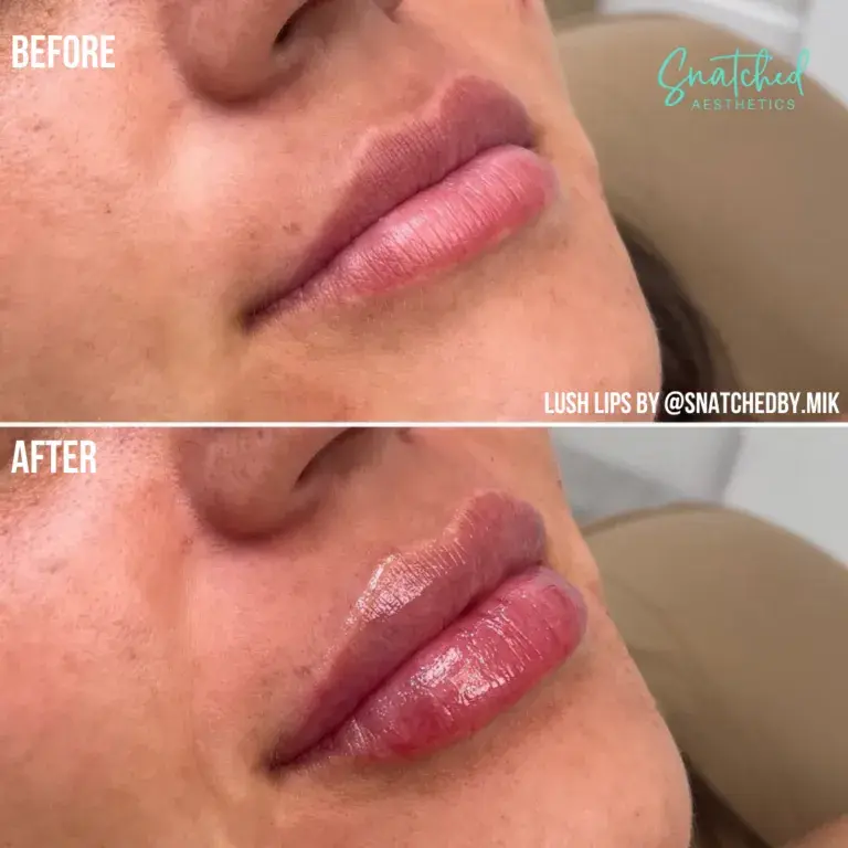 Snatched Aesthetics result — American Fork, UT