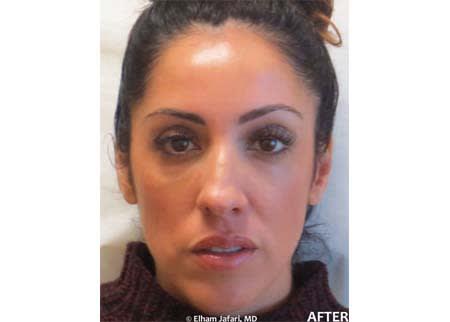 Amoderm Cosmetic and Wellness Medical Center after — Irvine, CA