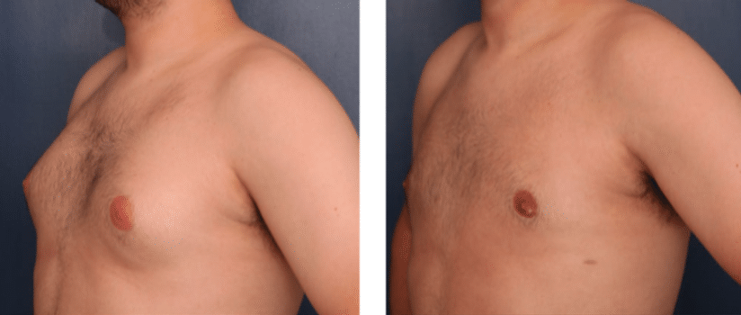 Ronald H. Schuster, MD result — Timonium, MD