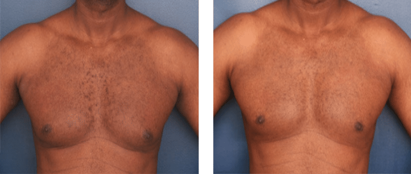 Ronald H. Schuster, MD result — Timonium, MD