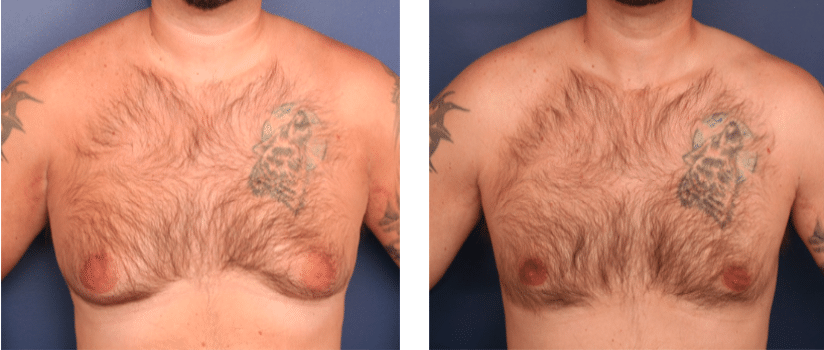 Ronald H. Schuster, MD result — Timonium, MD
