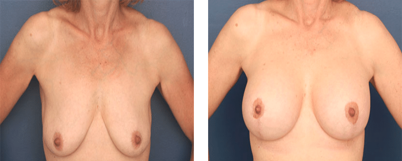 Ronald H. Schuster, MD result — Timonium, MD