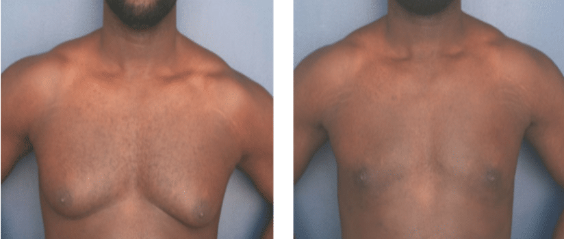Ronald H. Schuster, MD result — Timonium, MD