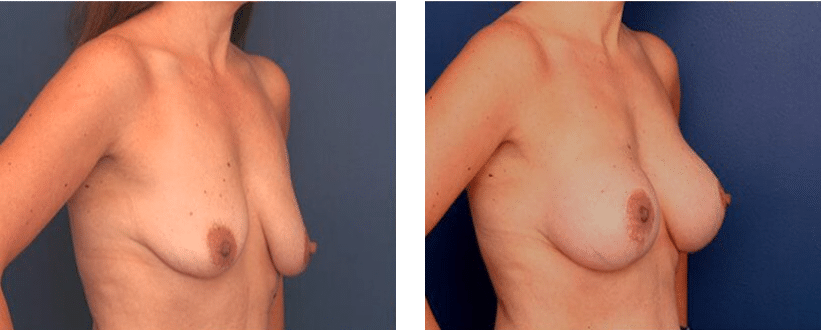 Ronald H. Schuster, MD result — Timonium, MD