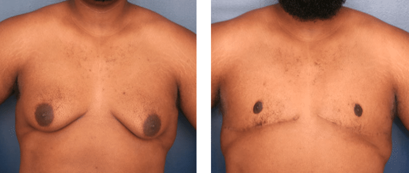 Ronald H. Schuster, MD result — Timonium, MD