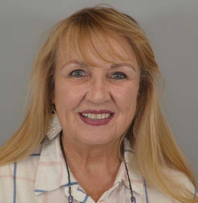 Facelift before at Jordan L. Wallin, MD in St. George, UT